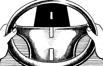 La diversificación, otra vía para superar los malos momentos